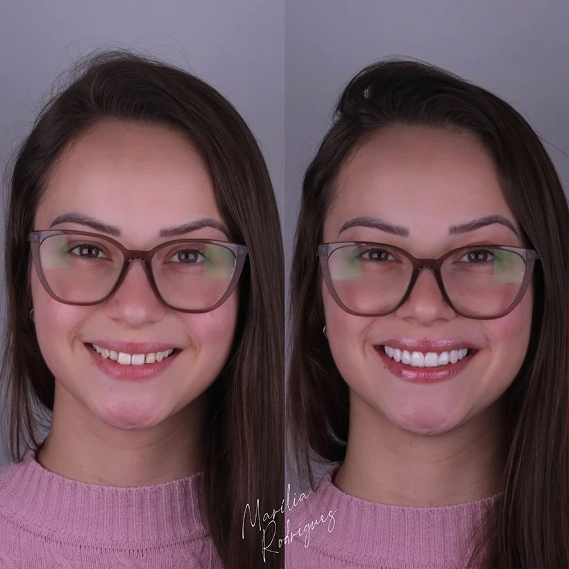 Antes-e-depois-2